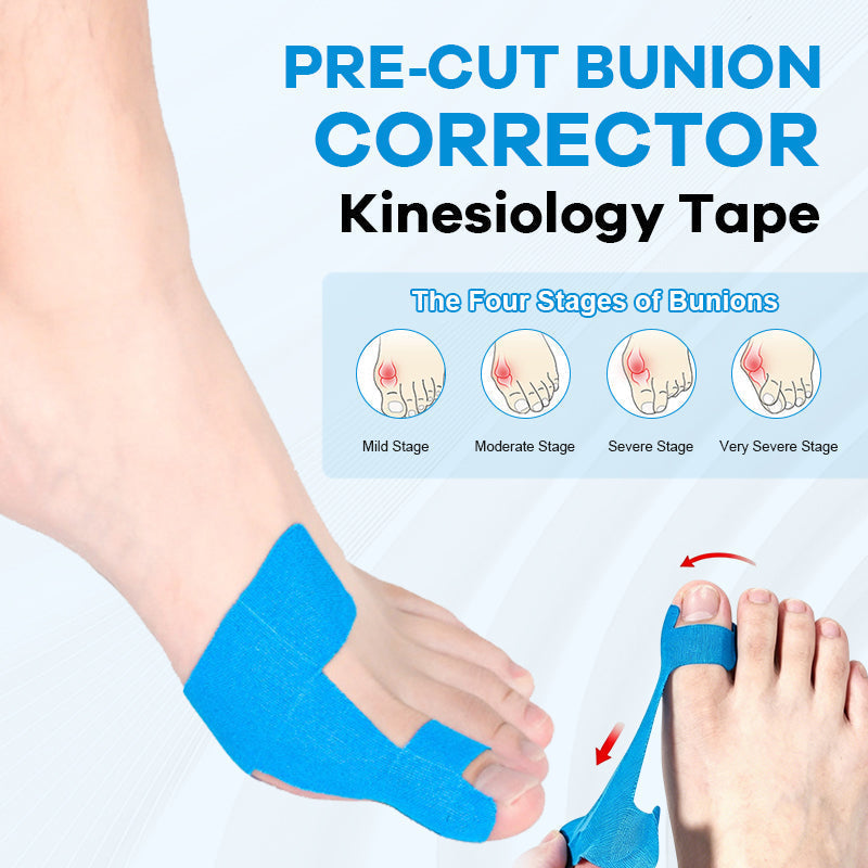 Pre-cut bunion kinesiology tape on a foot