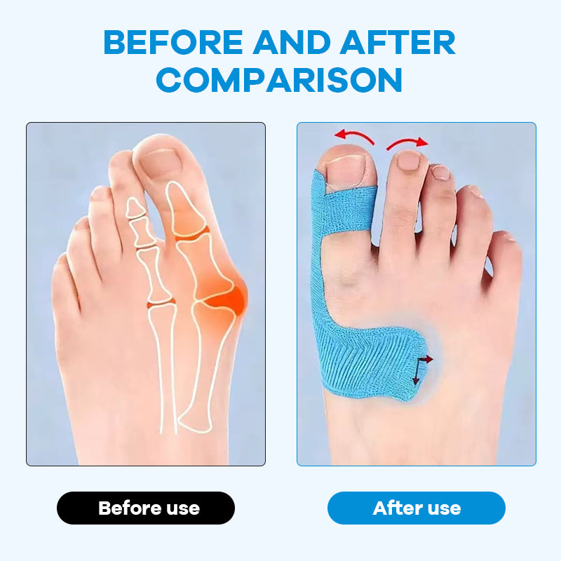 Toe support with flexible tape