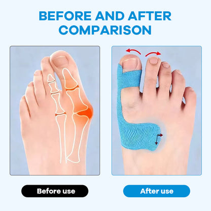 Toe support with flexible tape