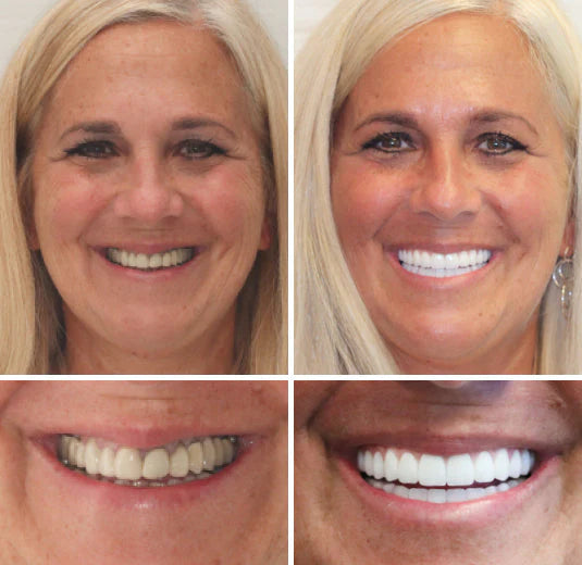 Source smile testimonial illustration — Mary