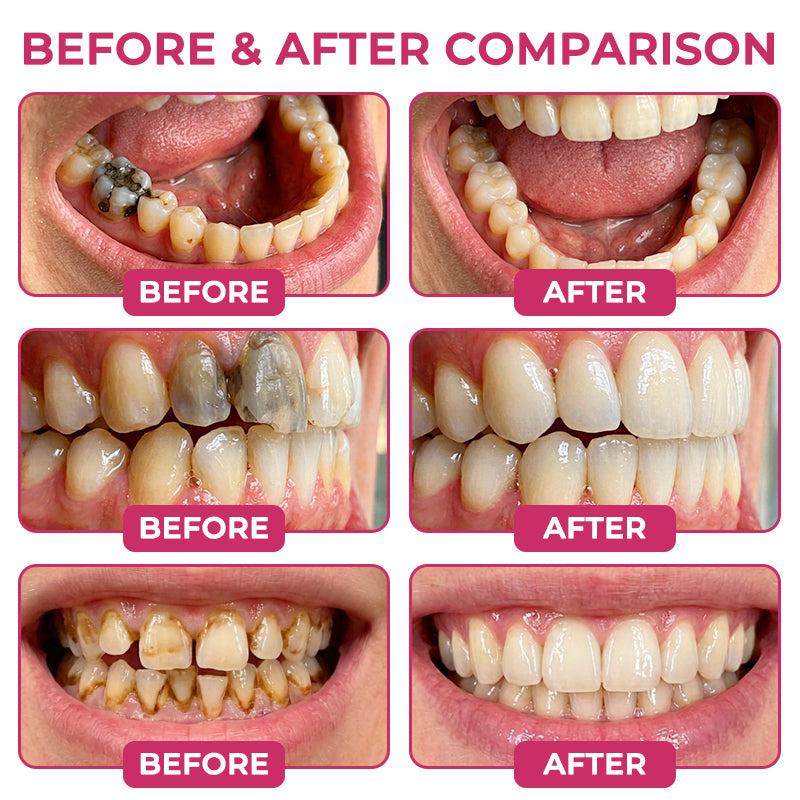 Aravelia enamel care gel — reference artwork 2