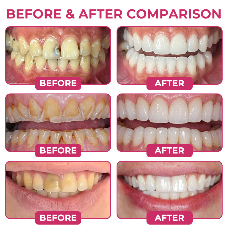 Aravelia enamel care gel — reference artwork 3
